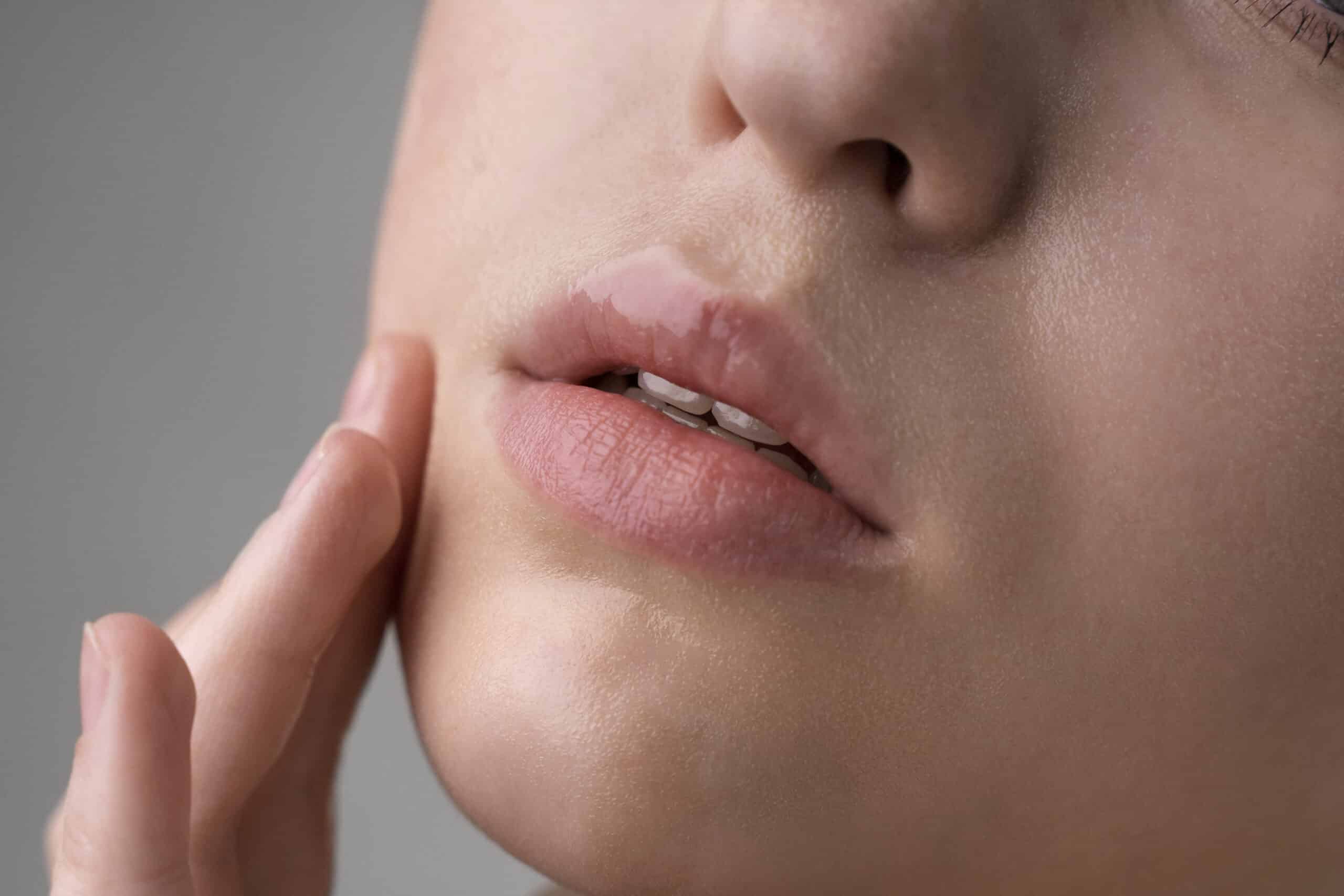 Non-Surgical Nose Job: PDO Thread Lift Vs Dermal Fillers – Lumina Aesthetics